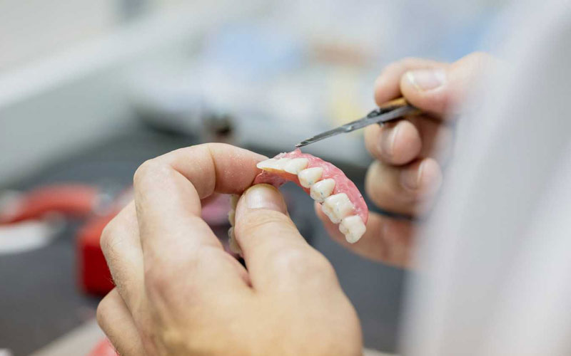 creating-a-denture - Aesthetic Dental and Denture Clinic