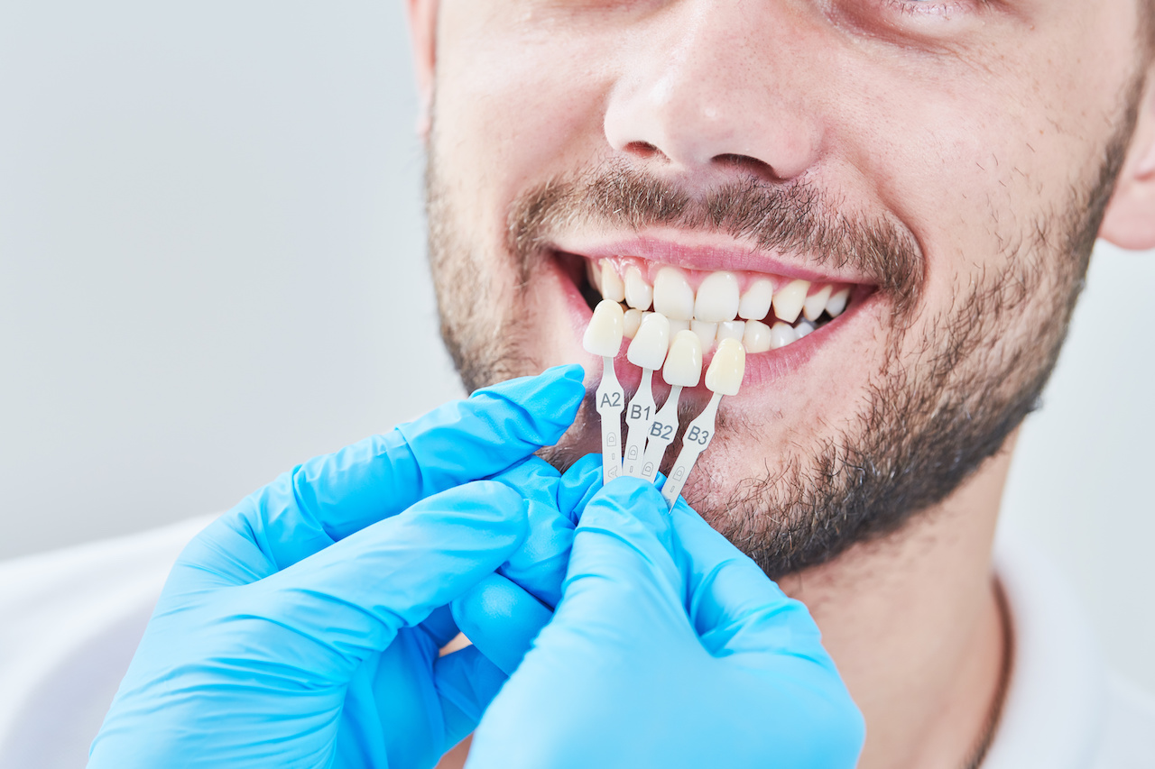 Cosmetic dentistry at Aesthetic Dental & Denture Clinic