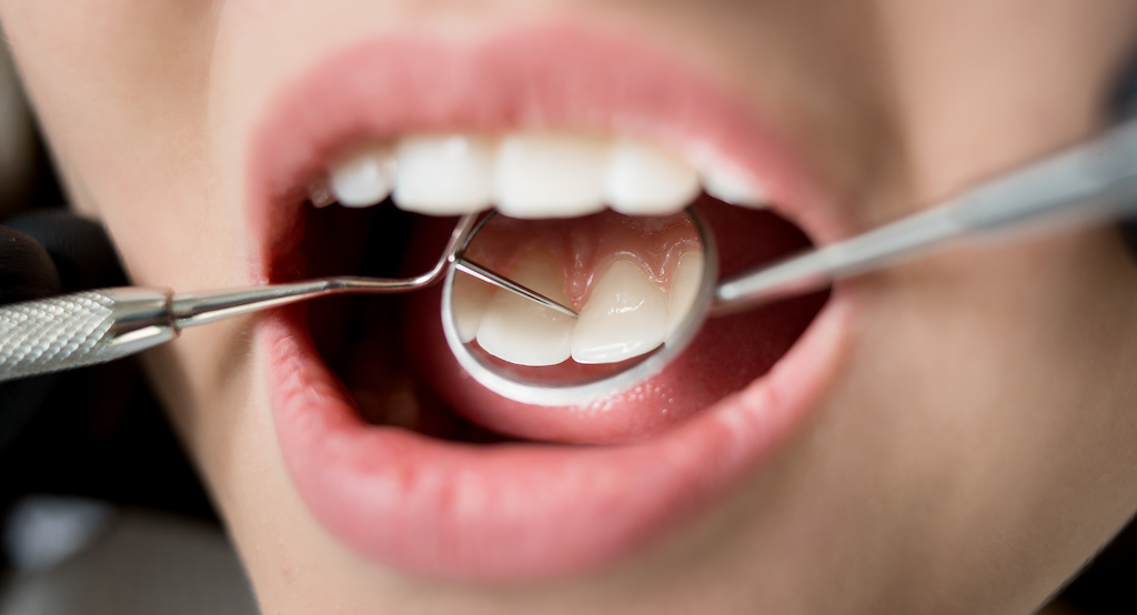Dental Check Up at Aesthetic Dental & Denture Clinic